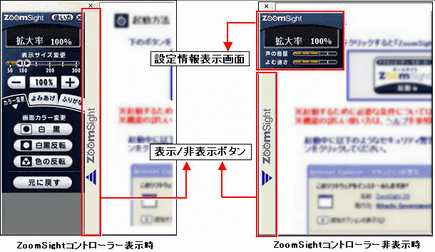 �摜 �R���g���[���[�\�����Ɣ�\����